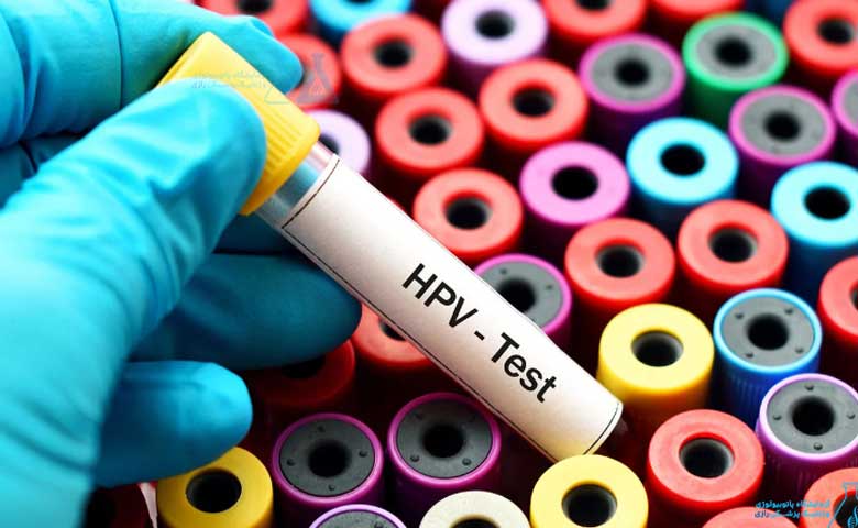 hpv teast