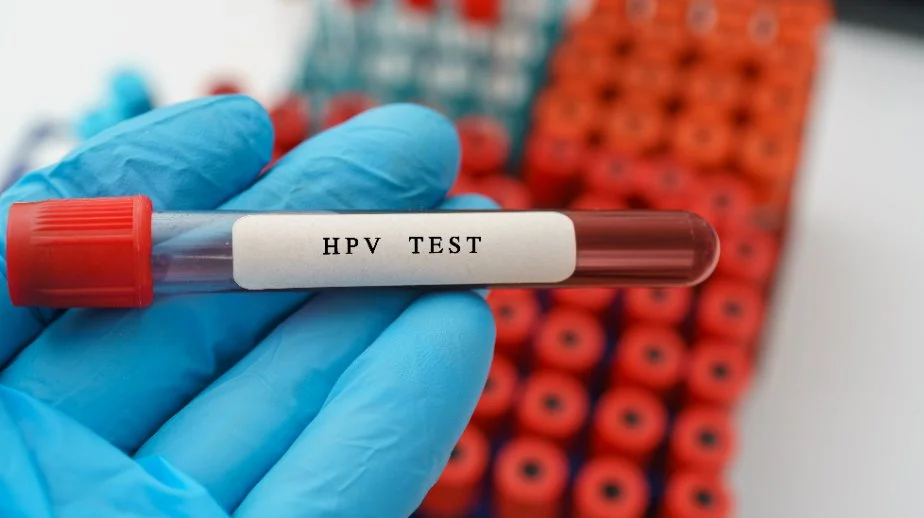 آزمایش HPV چیست؟