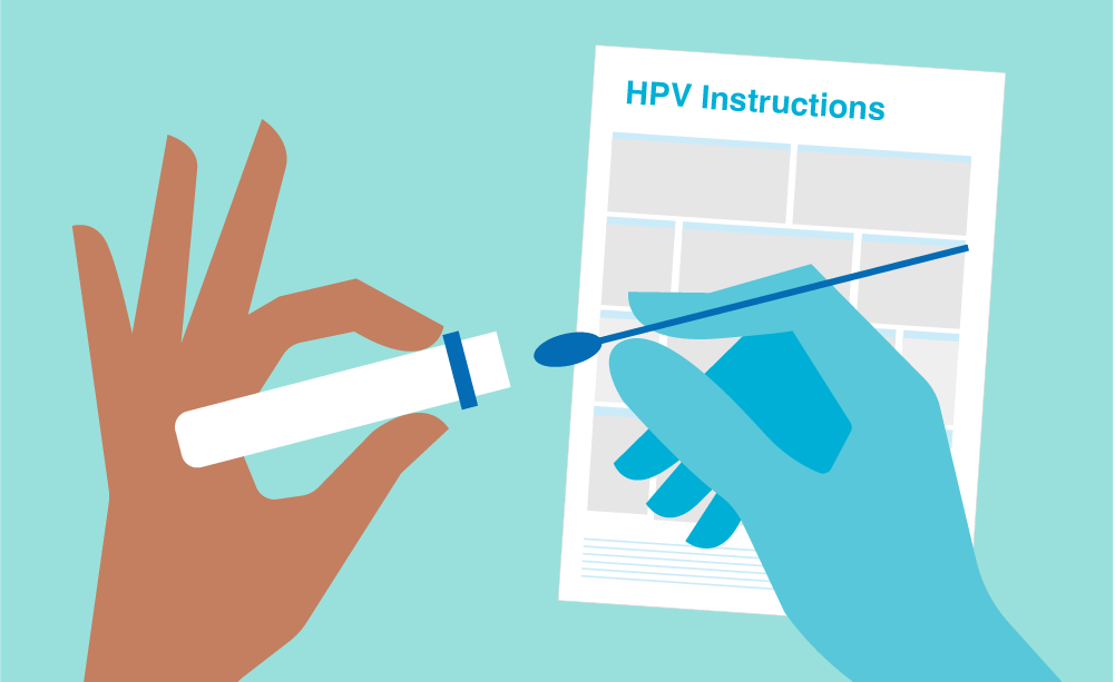 مراحل انجام آزمایش hpv